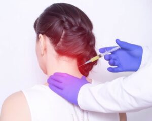 Cervical Epidural Injection A Comprehensive Guide To Understanding And