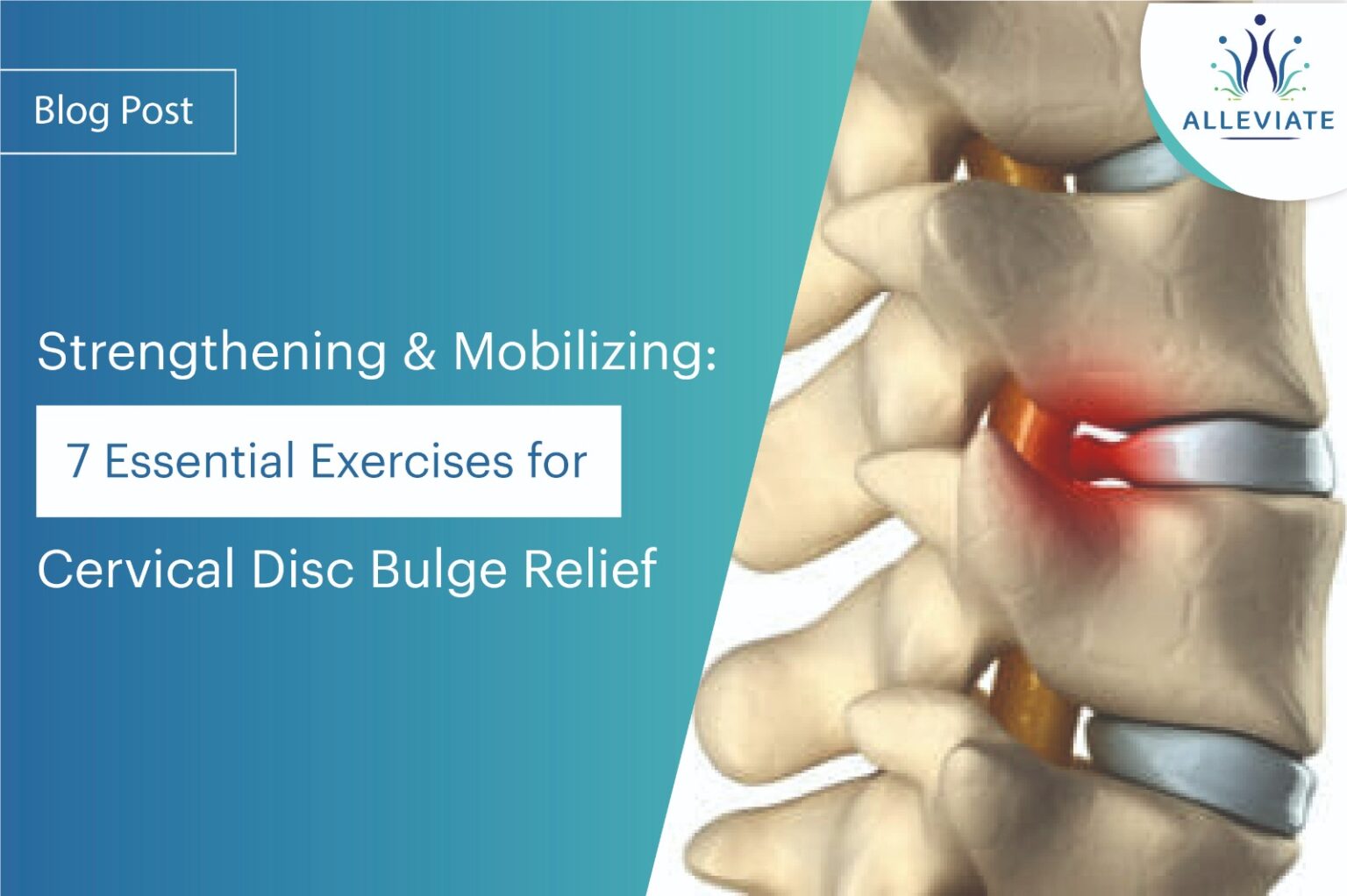 7 Essential Exercises for Cervical Disc Bulge Relief | Alleviate Pain ...