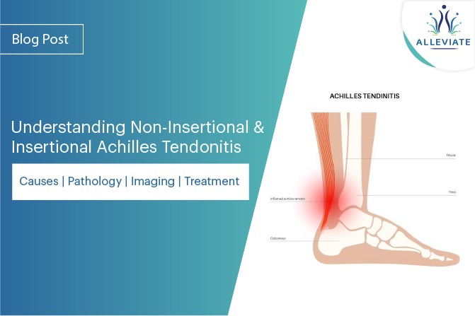Achilles Tendonitis: Treatment and Prevention – Clark Podiatry Center