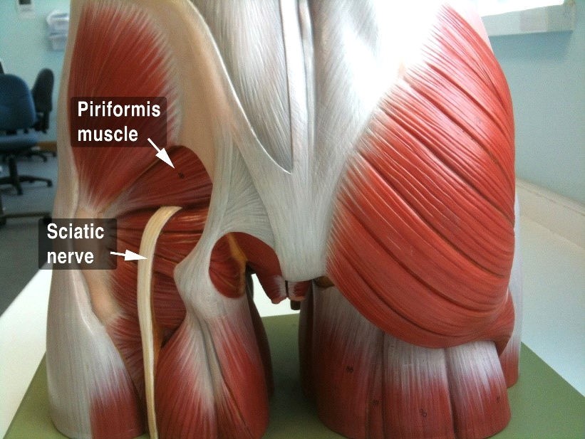 Piriformis Syndrome Chicago, Carpal Tunnel Syndrome
