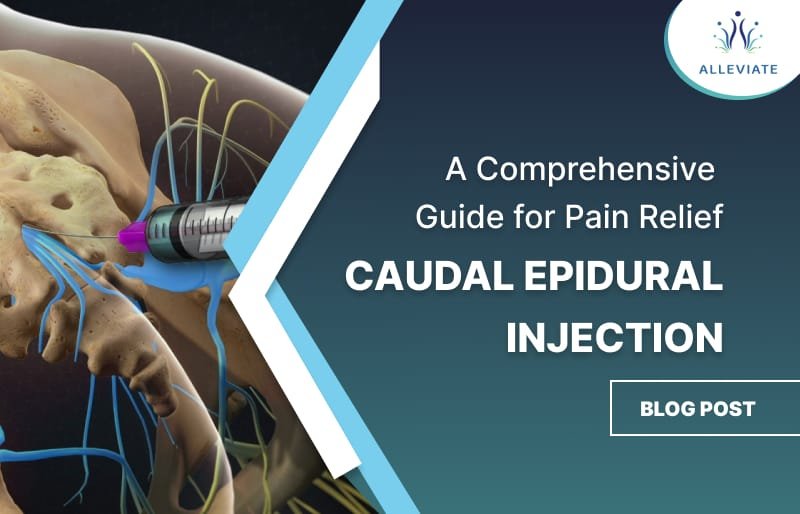 Caudal Epidural injection blog thumbnail list