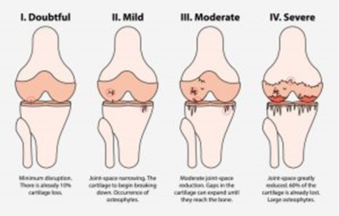 knee blog 01