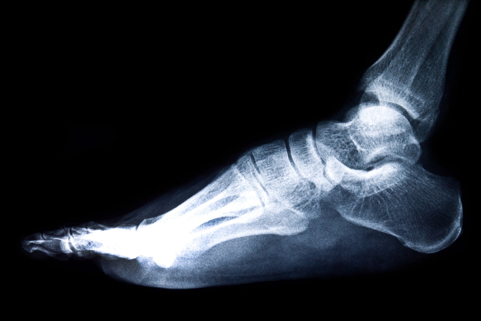 x ray film
