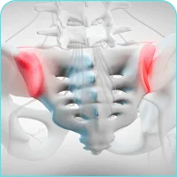Sacroiliac Joint Dysfunction