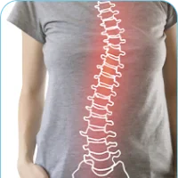 Scoliosis