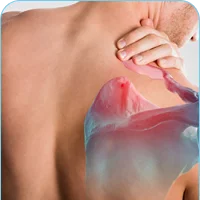 Glenoid Labral Tears