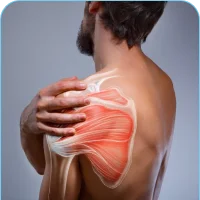 Rotator Cuff Injuries