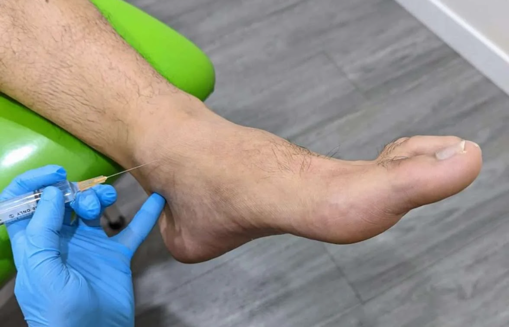 Non Surgical Foot Ankle Pain Treatment Google Drive 12 08 2025 03 24 PM