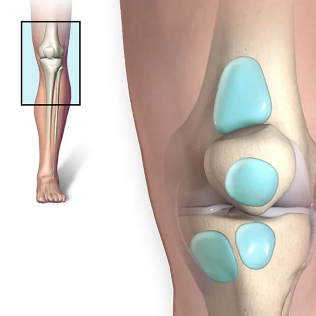 00 0002 Knee Bursitis