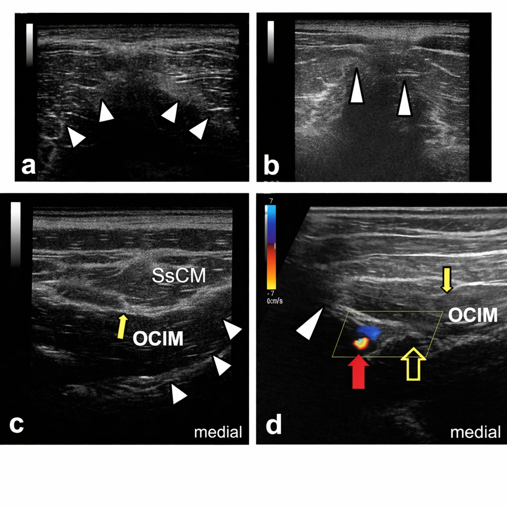 Nerve Based Interventional Treatments