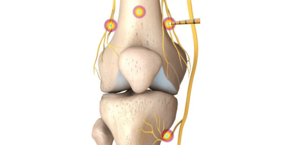 specialty image